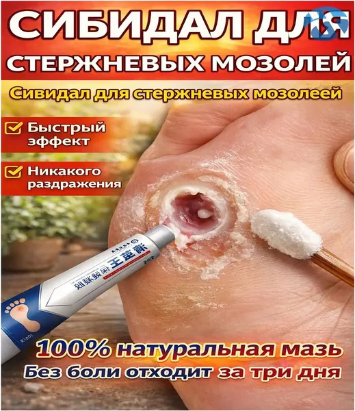 Средство от шипиц, натоптышей и сухих стержневых мозолей на ногах мазь и гель Корнекс,эффективное китайское средство