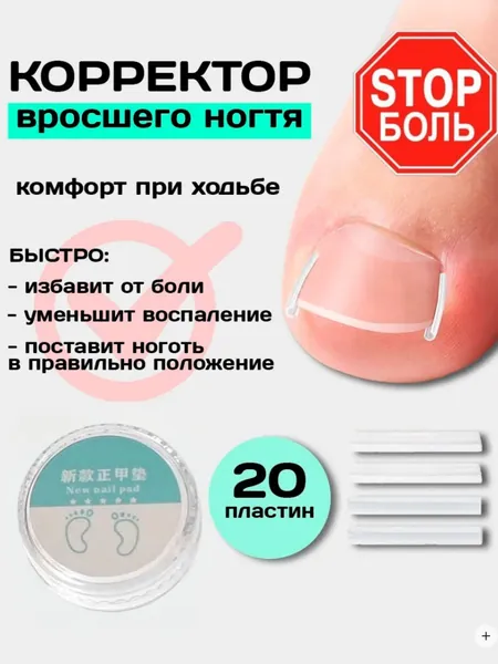 Корректор От Вросшего Ногтя