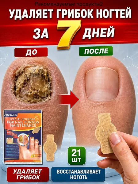 Пластыри от грибка, быстро помогают убрать желтизну, утолщенную пластину, трещины, зуд и неприятный запах, глубокое очищение, укрепление и восстановление, защита при онихомикозе для рук и стоп, 210 шт