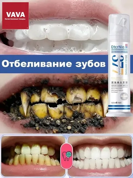 Отбеливающая зубная паста 120 г / упаковка. Удаляет зубной камень, осветляет эмаль, освежает дыхание, предотвращает кариес, снижает чувствительность зубов, уход за полостью рта.