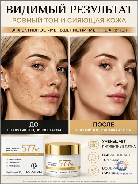 577 Крем для осветления кожи и удаления пигментных пятен эффективно удаляет старческие пятна, веснушки и пигментные пятна, борется с гиперпигментацией и улучшает цвет лица, 50 г