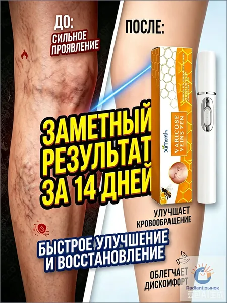 Медицинский лазер для удаления варикозного расширения вен. Безболезненное удаление варикозных вен, сосудистых звездочек и тромбов. отёки ног и тяжесть.Улучшает кровообращение. 1 шт.