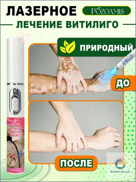 Лазерная ручка, разработанная специально для витилиго, точно осветляет белые пятна и выравнивает тон кожи. Без боли всего один стик поможет вернуть чистой, ровной и сияющей здоровой коже.