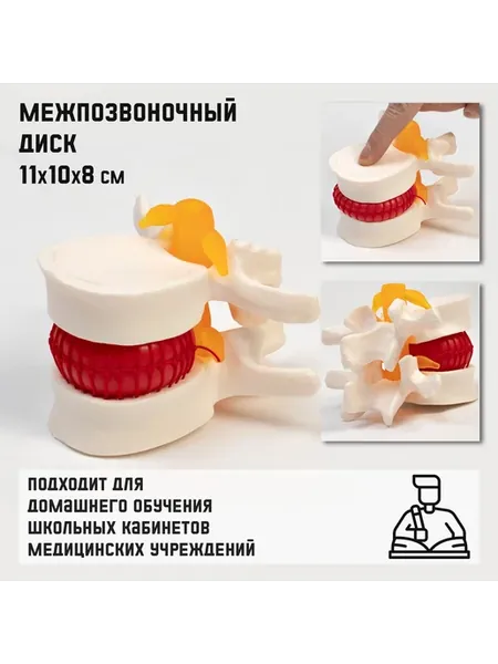 Макет Межпозвоночный диск