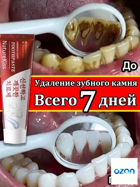 корейская отбеливающая зубная паста/100 г/Удаляет пятна от курения, зубной камень и налет, подходит для чувствительных зубов, кровоточивых десен, кариеса/освежает дыхание