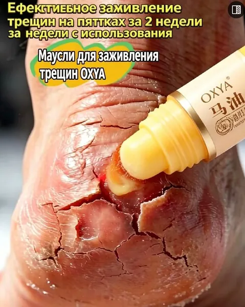крем от трещин на пятках, стик для ног, конское масло для увлажнения кожи, уход за пятками, средство от сухости ног, мозоли и натоптыши, зимний уход за кожей, компактный крем для рук и ног