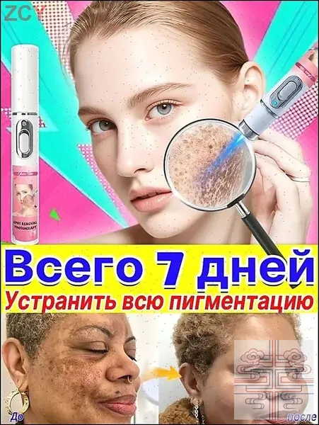 Удаляет пигментные пятна, веснушки, солнечные ожоги, меланодермию, угревую сыпь, морщины.Лазерная указка устраняет пигментацию на лице и теле и отбеливает кожу.1 палочка