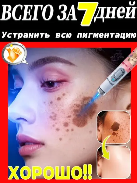 Удаляет пигментные пятна, веснушки, солнечные ожоги, меланодермию, угревую сыпь, морщины.Лазерная указка устраняет пигментацию на лице и теле и отбеливает кожу.1 палочка