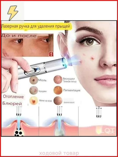 Удаляет пигментные пятна, веснушки, солнечные ожоги, меланодермию, угревую сыпь, морщины.Лазерная указка устраняет пигментацию на лице и теле и отбеливает кожу.1 палочка
