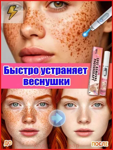 Лазерная ручка от веснушек эффективно удаляет веснушки, пигментные пятна и макулярные пятна, отбеливает кожу, восстанавливает ее и придает коже сияние.1 штука