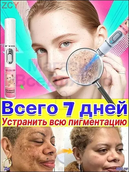 Удаляет пигментные пятна, веснушки, солнечные ожоги, меланодермию, угревую сыпь, морщины.Лазерная указка устраняет пигментацию на лице и теле и отбеливает кожу.1 палочка