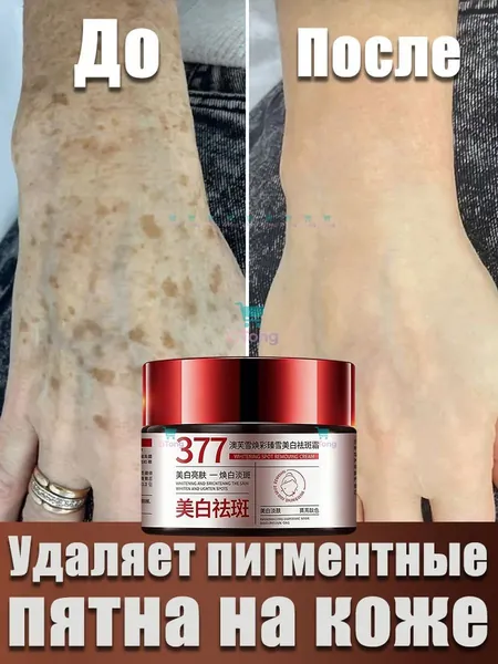 Крем для лица от пигментации 30 г осветляющий тон кожи