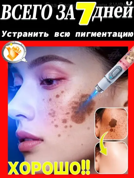 Удаляет пигментные пятна, веснушки, солнечные ожоги, меланодермию, угревую сыпь, морщины.Лазерная указка устраняет пигментацию на лице и теле и отбеливает кожу.1 палочка