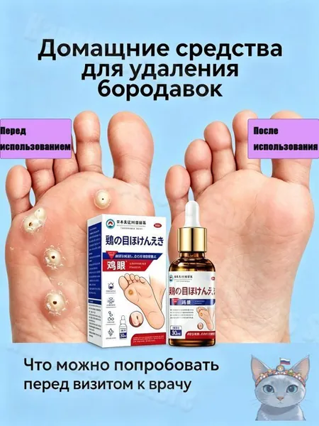 Средство для ухода за бородавками и натоптышами смягчает и увлажняет огрубевшую кожу, способствует удалению мозолей, поддерживает здоровье стоп и предотвращает образование новых.