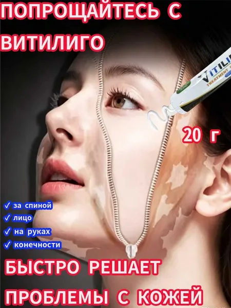 Крем от витилиго, Подходит для пациентов с витилиго, Эффективно удаляет белые пятна,устранения пигментации выравнивания тона кожи.средство для улучшения пигментации и выравнивания тона кожи, 20 г