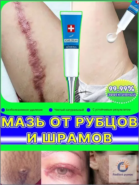Гель от рубцов: для лечения растяжек, угревой сыпи, ожогов, послеоперационных и келоидных рубцов, 60 мл