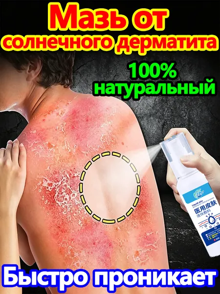Крем для лечения солнечного дерматита,Восстановление кожи после солнечных ожогов крем после загара