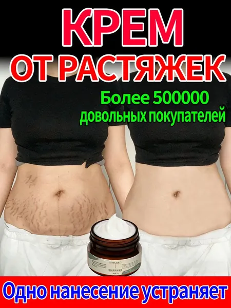 Крем от растяжек и стрий, средство против растяжек при беременности и после родов, восстановление эластичности и регенерация кожи, разглаживание рубцов для гладкости и шелковистости тела, 30 г