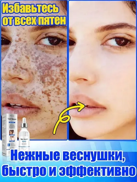Отбеливающее и от веснушек эфирное масло, осветляет на 7 дней, аккуратно удаляет различные пигментные пятна, восстанавливает после пребывания на солнце, повышает тонус кожи, питает и увлажняет.
