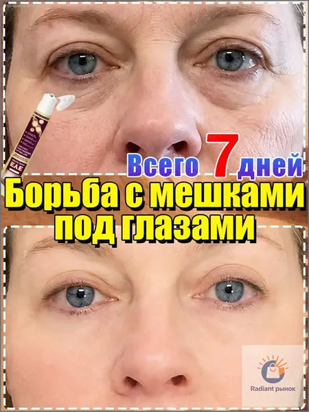 Антивозрастной роликовый крем для глаз, быстро разглаживает мелкие морщины, уменьшает отеки и темные круги под глазами, увлажняет и подтягивает кожу, восстанавливая ее молодость. 90 мл.