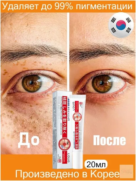 Содержит ниацинамид/Крем от пигментных пятен для лица Корея/20 мл/Содержит активные осветляющие компоненты/Устраняет мелазму, пигментацию, солнечные и тёмные пятна, интенсивно осветляет кожу