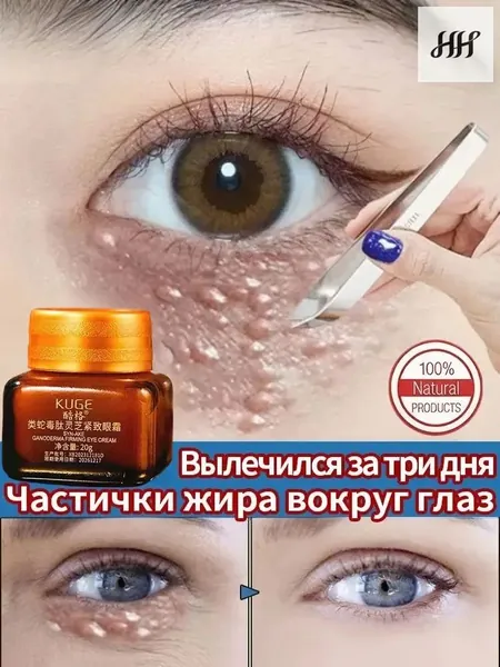средство от милиумов на лице, Крем для век антивозрастной, для зоны вокруг глаз, ретидерм крем для век антивозрастной, Чистый натуральный, от темных кругов и морщин, отёков вокруг глаз, 20 г