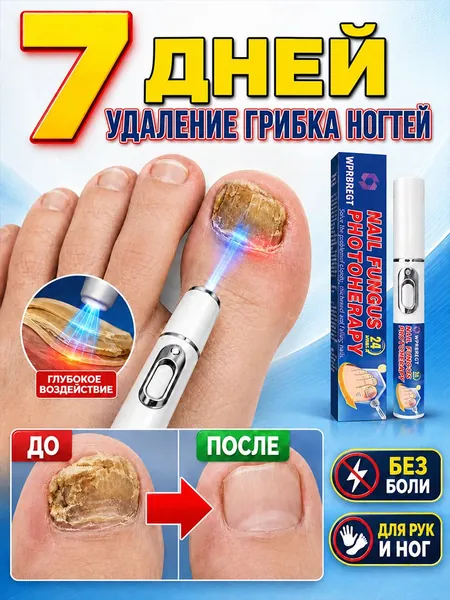 Лазерная указка, используемая для лечения грибка ногтей.Безболезненное лечение онихомикоза.Снимает зуд и воспаление околоушной области, способствует восстановлению и уменьшает воспаление.1 упаковка