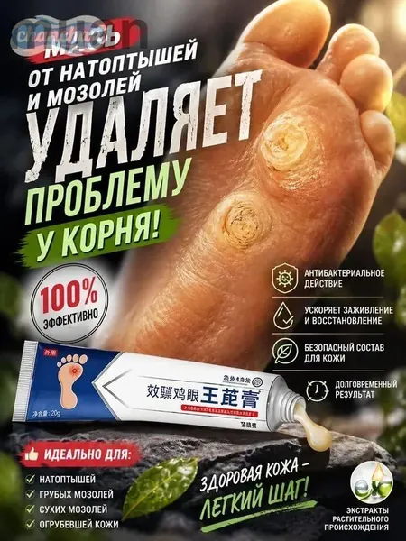 Мазь от мозолей стержневых и натоптышей 20 г; китайский крем для удаления бородавок, шипицы и сухих мозолей, эффективное средство от подошвенных бородавок на ногах с экстрактами трав