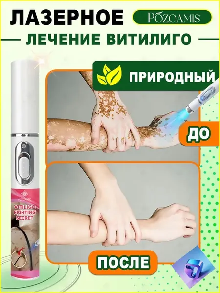 Премиумстик для коррекции витилиго, используемый для безопасного осветления участков депигментации и выравнивания тона. Одним бесконтактным сеансом восстанавливается чистота и сияние здорового покрова