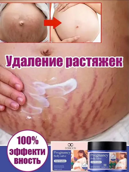 Крем от растяжек для беременных, Быстрое удаление растяжек, пигментации и шрамов,Послеродовые абдоминальные линии,восстанавливает эластичность кожи, подходит для ухода за кожей после родов 120 г.