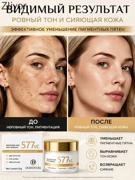 577 Крем для осветления кожи и удаления пигментных пятен эффективно удаляет старческие пятна, веснушки и пигментные пятна, борется с гиперпигментацией и улучшает цвет лица, 50 г