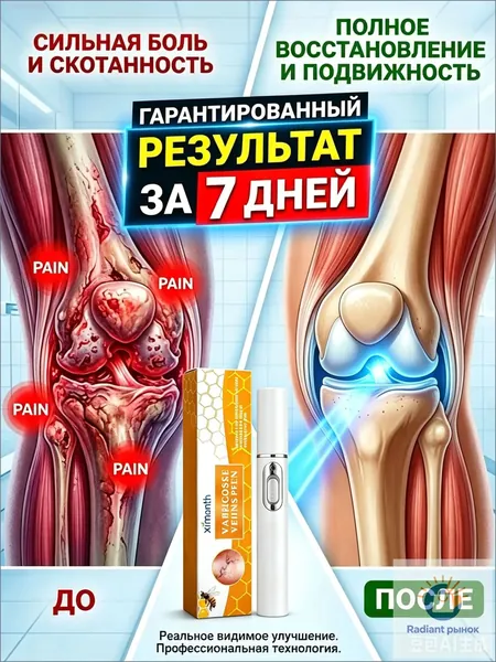 Обезболивающий лазерная указка при артрите,для снятия боли при подагре, артрите, опухших суставах, болях в спине, уменьшает отек и снимает боль,1 ШТ