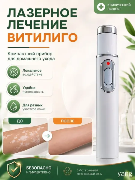 Лазерная ручка, разработанная специально для витилиго, точно осветляет белые пятна и выравнивает тон кожи. Без боли всего один стик поможет вернуть чистой, ровной и сияющей здоровой коже.