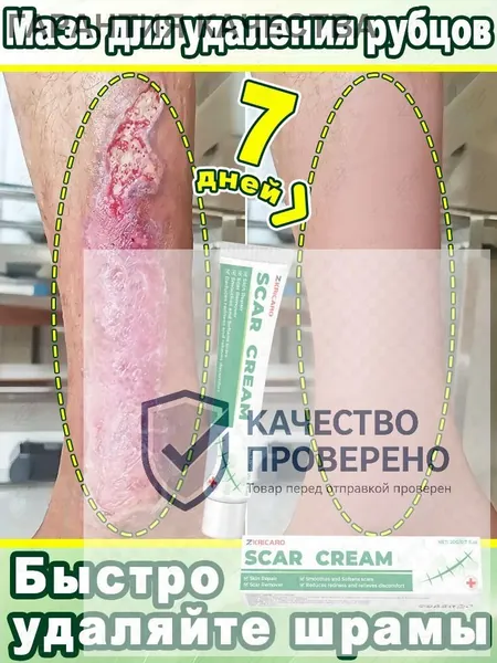 Крем от рубцов для лечения шрамов, травм и пигментации; выравнивает тон кожи, восстанавливает гладкость кожи и способствует быстрому заживлению рубцов. Подходит для любой части тела. 60