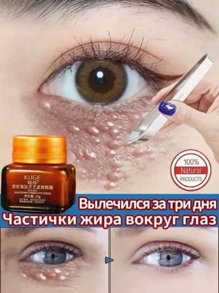 средство от милиумов на лице, Крем для век антивозрастной, для зоны вокруг глаз, ретидерм крем для век антивозрастной, Чистый натуральный, от темных кругов и морщин, отёков вокруг глаз, 20 г