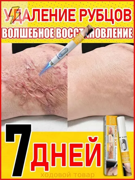 Лазерная ручка для удаления шрамов, удаляет шрамы, родинки, ожоги, растяжки, следы ожирения, лечит послеоперационные шрамы, предотвращает образование рубцов, восстанавливает кожу.1 упаковка