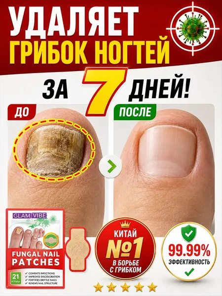 Пластыри от грибка ногтей, быстро удаляют грибок, проникают в ногтевое ложе, эффективно лечат желтизну, утолщение, зуд и неприятный запах, глубоко уничтожают грибок, подходят для рук и стоп, 21 шт