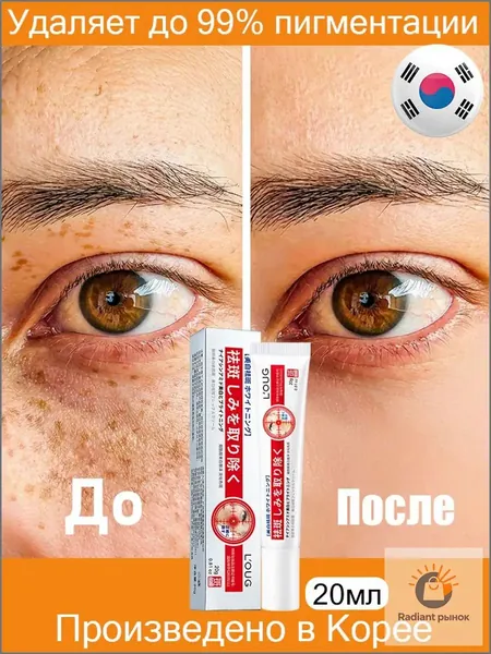 Содержит ниацинамид/Крем от пигментных пятен для лица Корея/20 мл/Содержит активные осветляющие компоненты/Устраняет мелазму, пигментацию, солнечные и тёмные пятна, интенсивно осветляет кожу