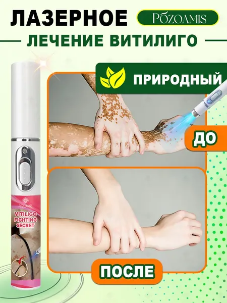 Лазерная ручка, разработанная специально для витилиго, точно осветляет белые пятна и выравнивает тон кожи. Без боли всего один стик поможет вернуть чистой, ровной и сияющей здоровой коже.