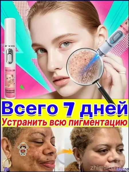 Премиумприбор лазерного типа, используемый для осветления кожи, коррекции пигментных пятен на теле и лице, нейтрализации веснушек, меланодермии, угревой сыпи, морщин и следов от солнечных ожогов, явл