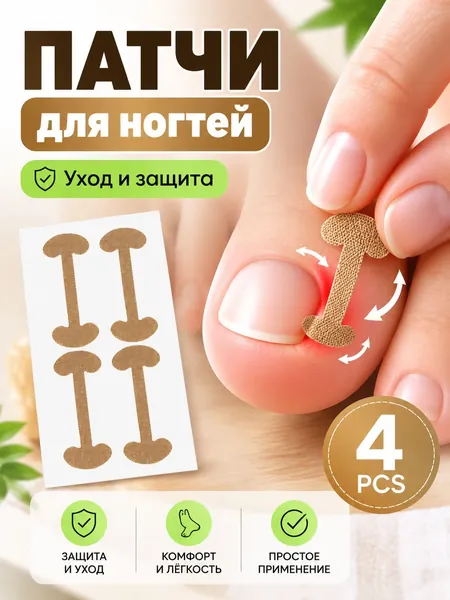 ORTGUT Набор наклеек для коррекции вросших ногтей / Пластырь для исправления пластины при онихокриптозе / Педикюрная корректирующая система для приподнимания ногтя на ноге - 4 шт.