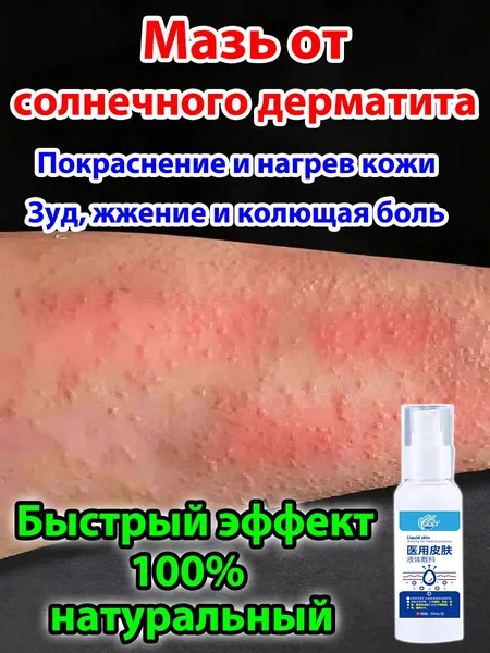 Крем для лечения солнечного дерматита,Восстановление кожи после солнечных ожогов крем после загара