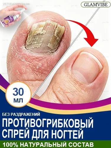 Интенсивный спрей от грибка ногтей 30 мл. Устраняет отслоение и утолщение, восстанавливает структуру, питает ногтевое ложе и стимулирует рост здоровых пластин. Для рук и ног.