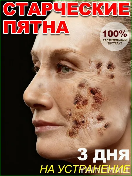 крем отбеливающий от пигментации для лица,ретидерм крем для лица антивозрастной,веснушек и пигментных пятен,отбеливающий для лица увлажняющий, Содержит гиалуроновую кислоту и 377.