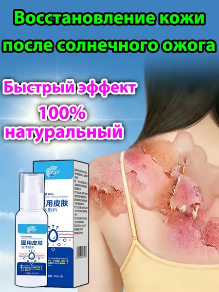 Крем для лечения солнечного дерматита,Восстановление кожи после солнечных ожогов крем после загара
