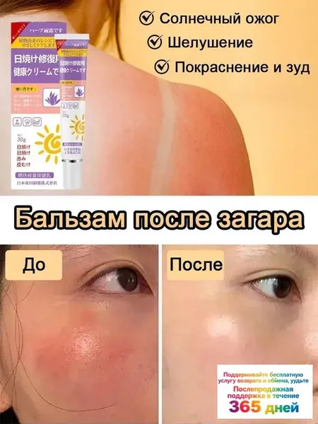 Бальзам после загара, Снимает покраснение шелушение и зуд после солнечных ожогов, Содержит алоэ вера ментол и жимолость, 30 г