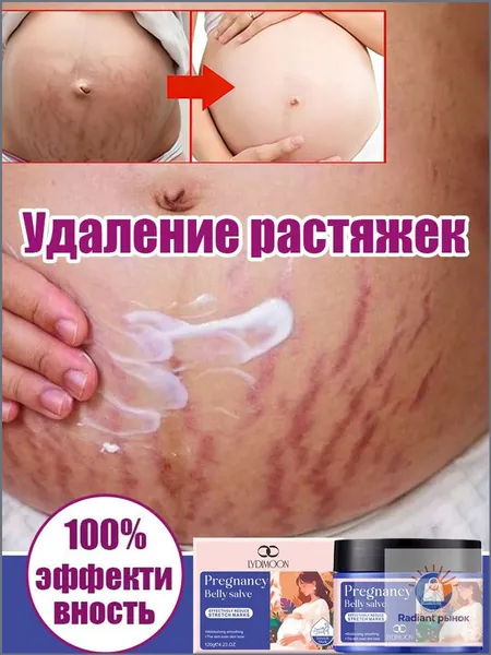 Крем от растяжек для беременных, Быстрое удаление растяжек, пигментации и шрамов,Послеродовые абдоминальные линии,восстанавливает эластичность кожи, подходит для ухода за кожей после родов 120 г.