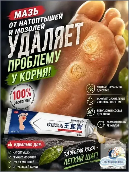 Премиальный китайский крем для удаления бородавок, сухих мозолей и шипицы, содержащий травяные экстракты, применяемый от подошвенных наростов на ступнях, представлен в объеме 20 граммов